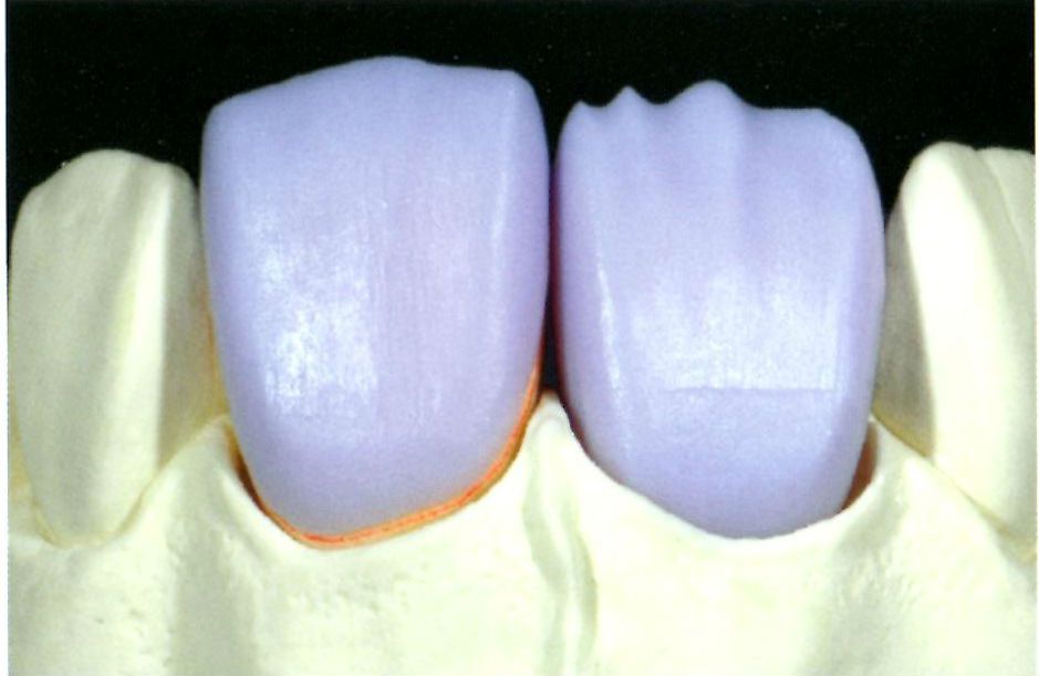 cerec inLab 3d