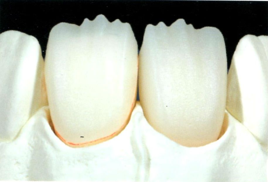 cerec inLab 3d