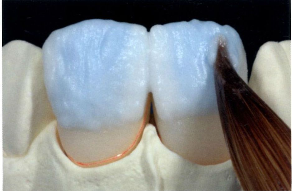 cerec inLab 3d