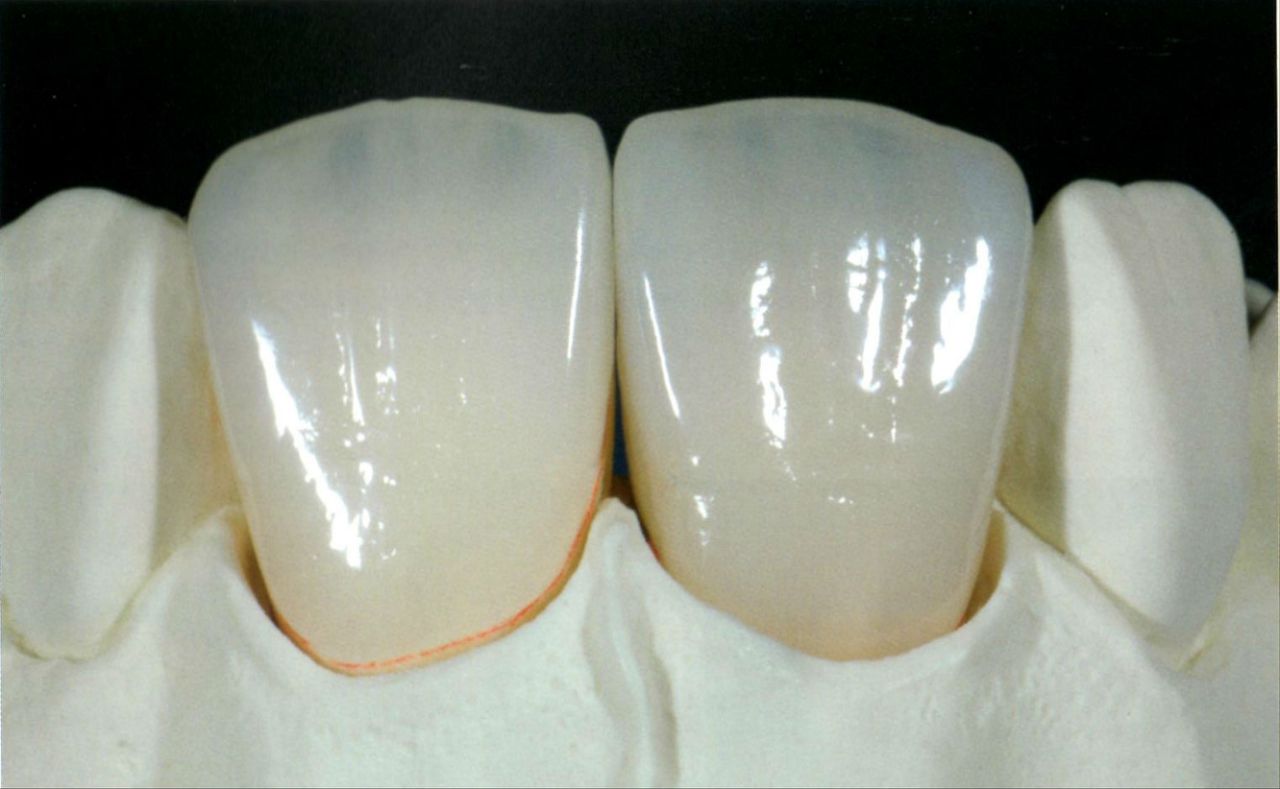 cerec inLab 3d
