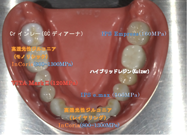 新素材セラミック
